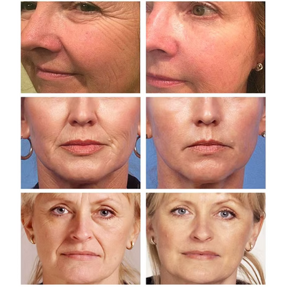 Mamushi ARG® Mask 30 ml - Botox Effect Μάσκα νύχτας με Argireline