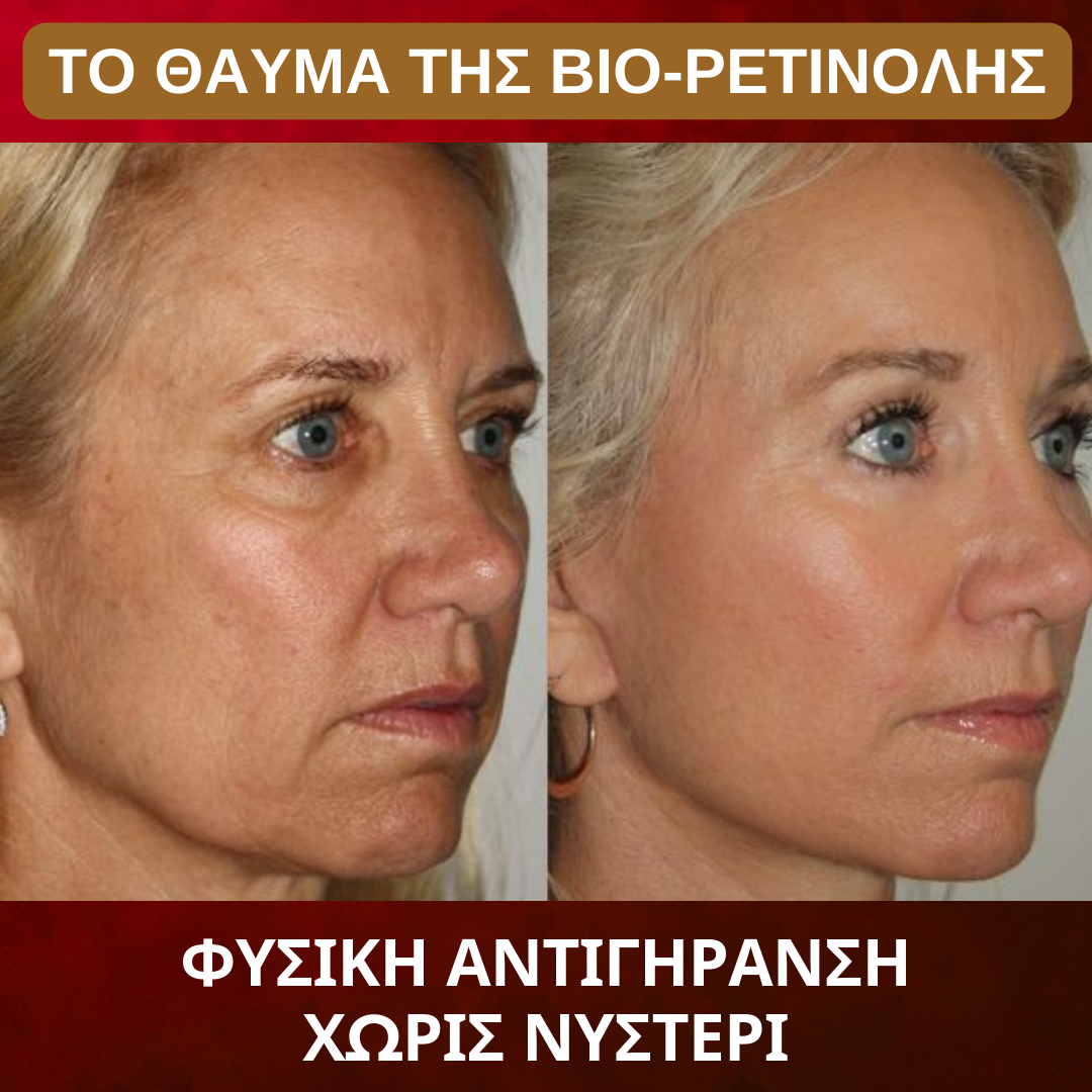 Bakuchiol BioRetinol - Αντιγηραντική Κρέμα Ημέρας