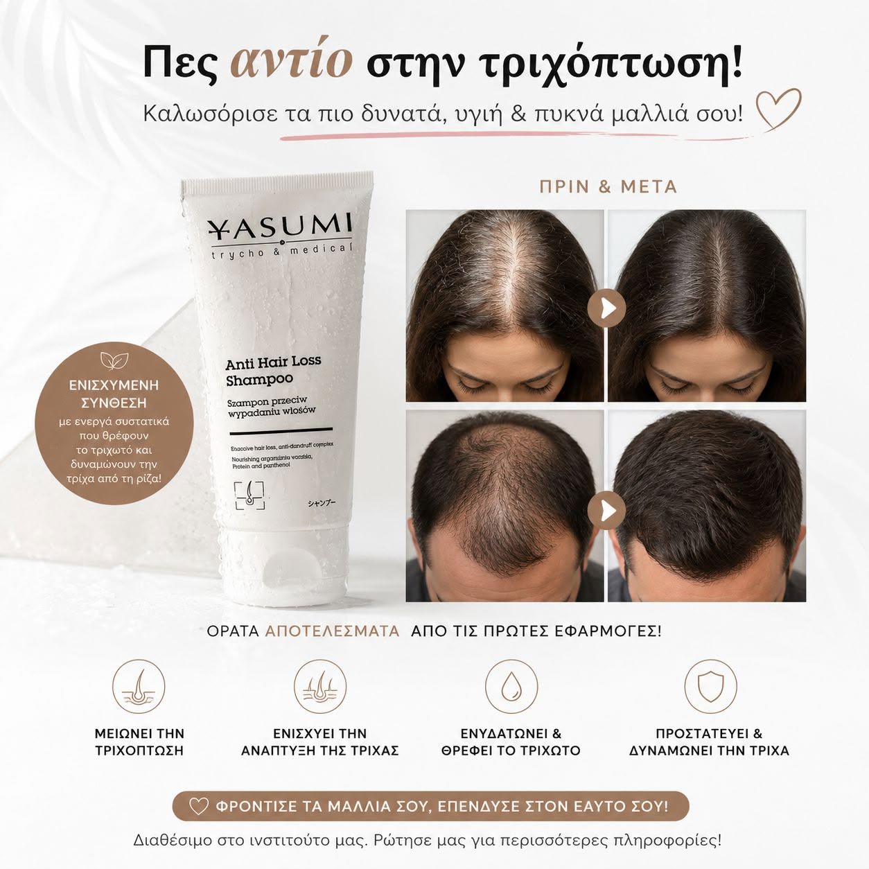 Anti Hair Loss Shampoo 200 ml