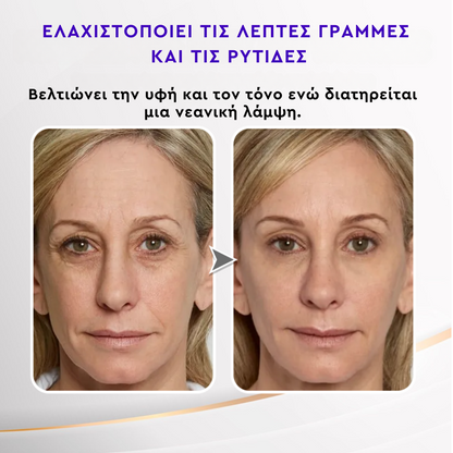 Κρέμα Ματιών με Βλαστοκύτταρα - Stem Cells Eye Contour 15ml
